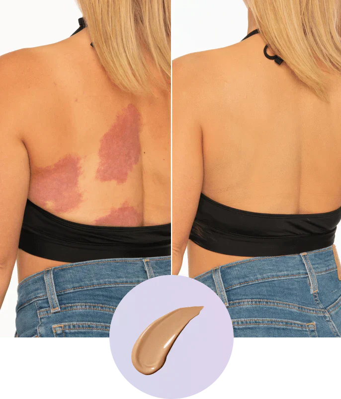 💜Último día: ¡Compra 1 y llévate 1 gratis!💜✨Perfeccionador de cobertura corporal: maquillaje corporal resistente al agua, ligero e impecable