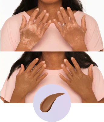💜Último día: ¡Compra 1 y llévate 1 gratis!💜✨Perfeccionador de cobertura corporal: maquillaje corporal resistente al agua, ligero e impecable